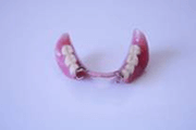 可撤式義歯2